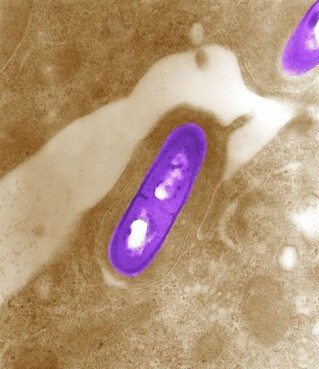 Listeria bacterium